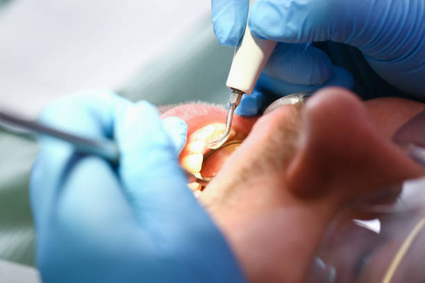 Best Emergency Gum Pain Relief  in Springfield, KY
