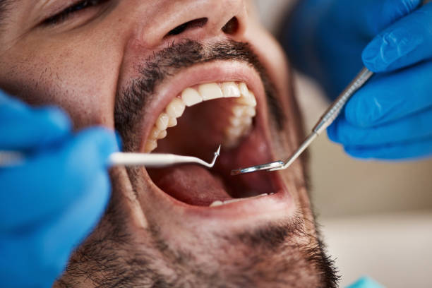 Best Knocked-Out Tooth Emergency  in Springfield, KY