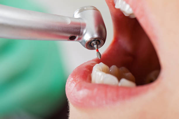 Best Cracked Tooth Emergency Dentist  in Springfield, KY